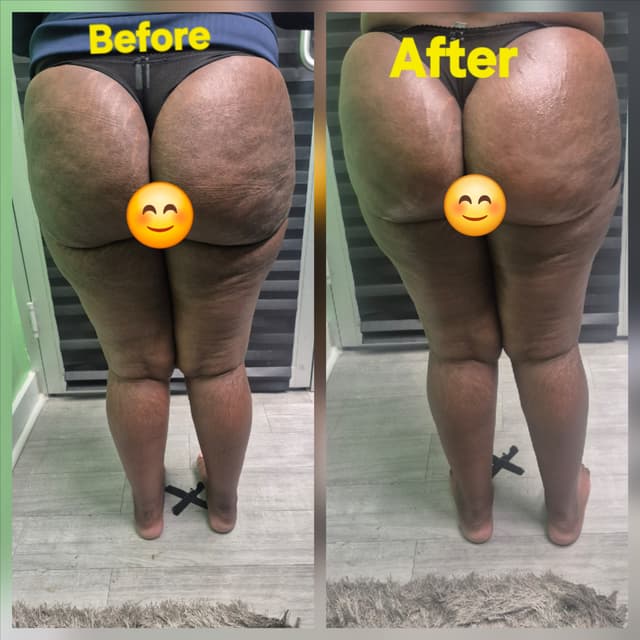 👉  Booty Maintenance Membership at JUST BEAUTIFUL SKIN in Goose Creek, SC